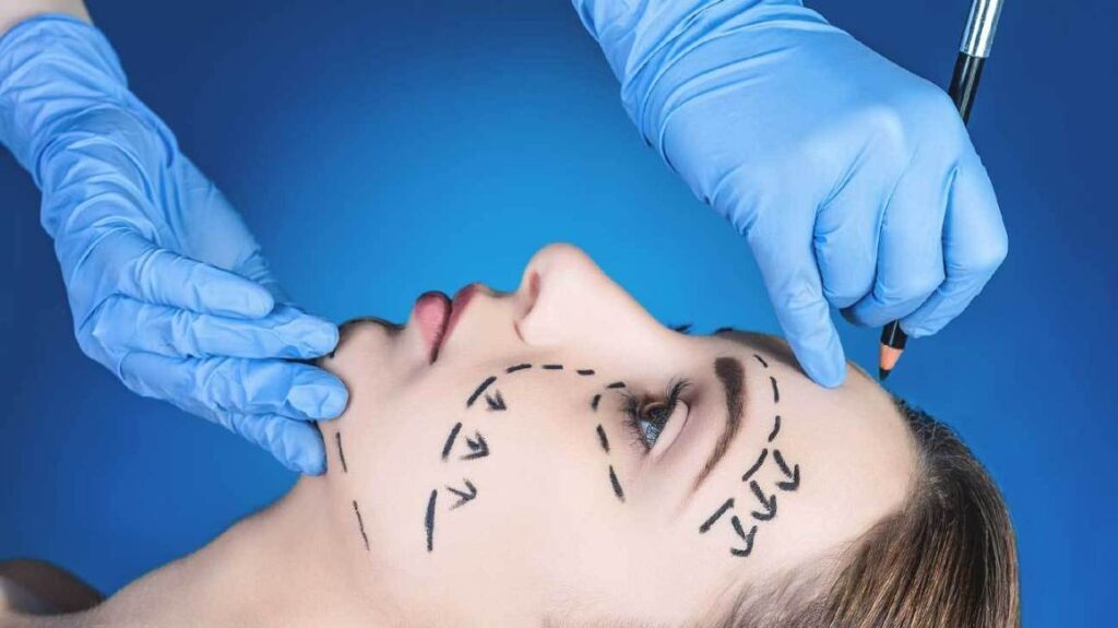 What is facelift surgery?