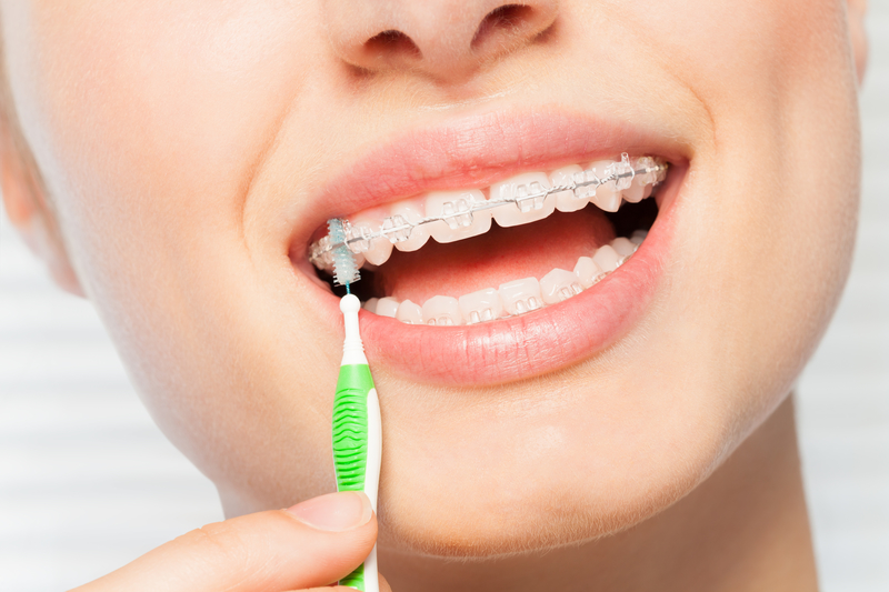 Tooth Decay: What to Do To Prevent Cavities?